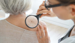 An Older Woman Getting a Skin Cancer Check From a Doctor