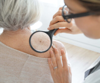 An Older Woman Getting a Skin Cancer Check From a Doctor