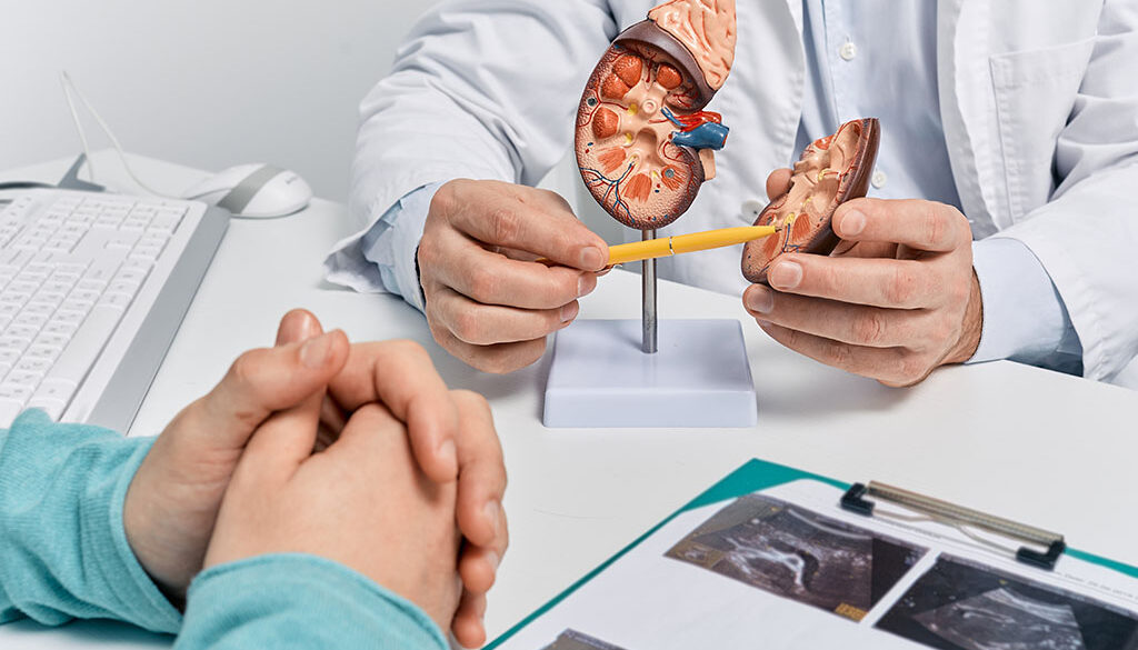 A Doctor Showing a Patient a Model of a Kidney How Long Does It Take to Pass a Kidney Stone