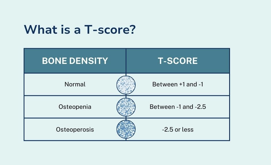 What is a t-score for bone density
